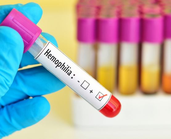 Buenas noticias en el tratamiento de la hemofilia: una de las 8.000 enfermedades raras en el mundo