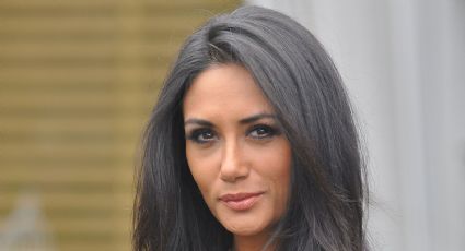 Pamela Díaz sorprendió con inesperado parche en el ojo: “Tenía una bolita que caminaba sola casi”