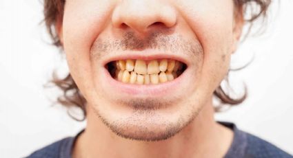 Café sin culpas: cómo disfrutarlo sin manchar tus dientes