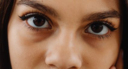 Dile adiós a las ojeras: esto tienes que hacer para eliminarlas por completo de tu rostro