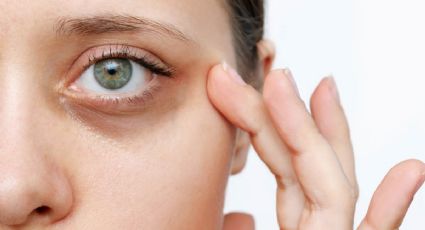 La forma más efectiva de reducir las ojeras en tiempo récord