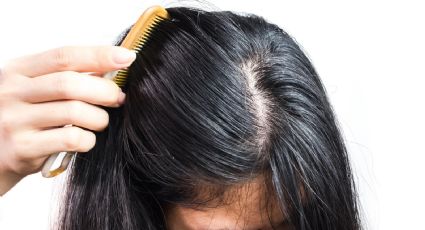 Dile adiós al cabello graso sin gastar en productos caros o en salones de belleza