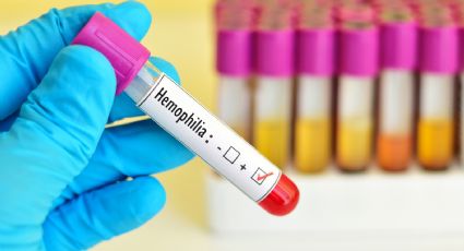 Buenas noticias en el tratamiento de la hemofilia: una de las 8.000 enfermedades raras en el mundo
