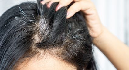 ¿Se pueden eliminar las canas de forma natural? Verdades y alternativas que sí funcionan