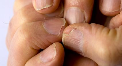 Uñas más fuertes y resistentes: cómo endurecerlas de forma natural y efectiva