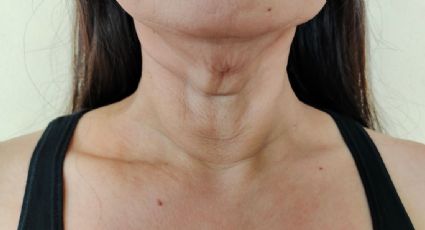 Cómo tonificar la flacidez del cuello de manera natural: ejercicios efectivos que sí funcionan